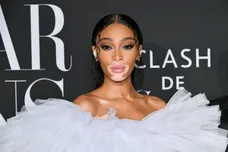 winnie harlow net worth