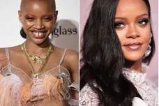 Steven Ferdman/Getty Images and Dimitrios Kambouris/Getty Images