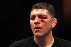 Photo by Steve Marcus/Getty Images