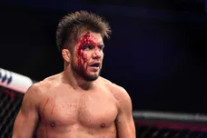 Douglas P. DeFelice/Getty Images