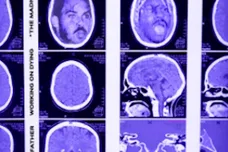 Image via Working On Dying