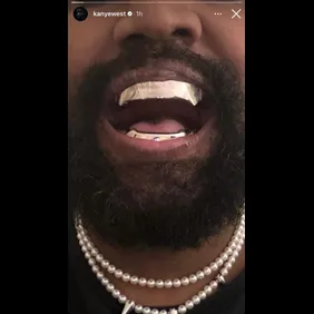 Kanye-West-Metal-Teeth