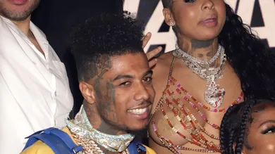 BluefaceBabyHerniaPhotoChriseanRock