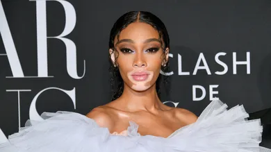 winnie harlow net worth