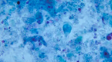 Smith Collection/Gado/Getty Images