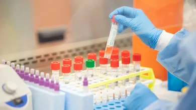 Andrew Theodorakis/ Getty Images