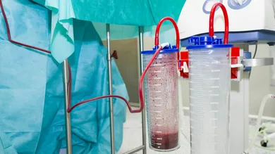 BSIP / Contributor / Getty Images