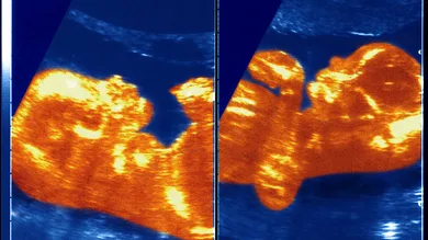 BSIP/UIG Via Getty Images