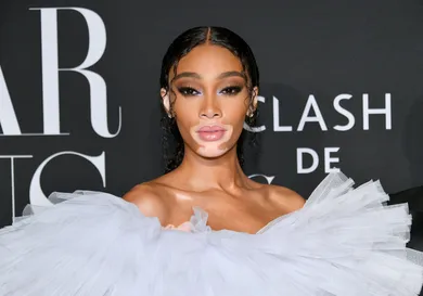 winnie harlow net worth