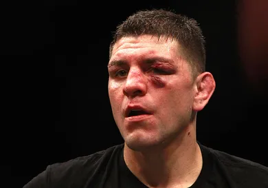 Steve Marcus/Getty Images