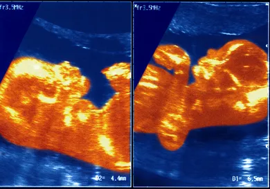 BSIP/UIG Via Getty Images