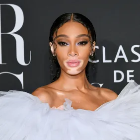 Winnie Harlow Poses Nude For "Women's Health" Cover Shoot: Photos